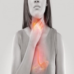 What Are Common Signs of Acid Reflux?